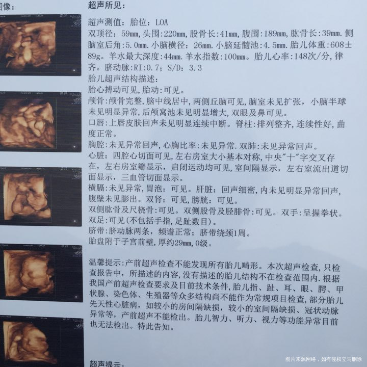 刚做的四维,医生帮忙,看看