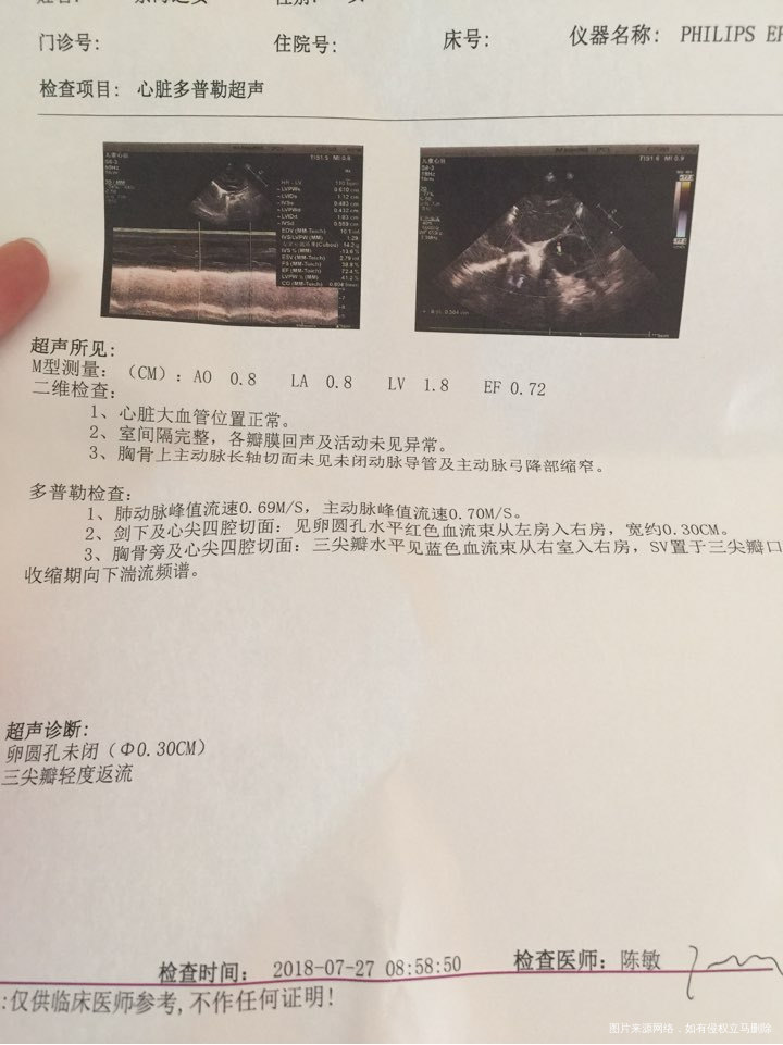医生,帮忙看看,宝宝的心脏B超,宝宝7.25中午11.50出生的