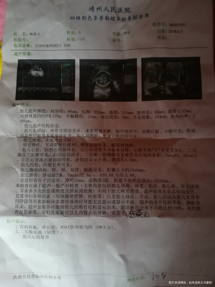 医生帮我看看这个四维有问题吗?