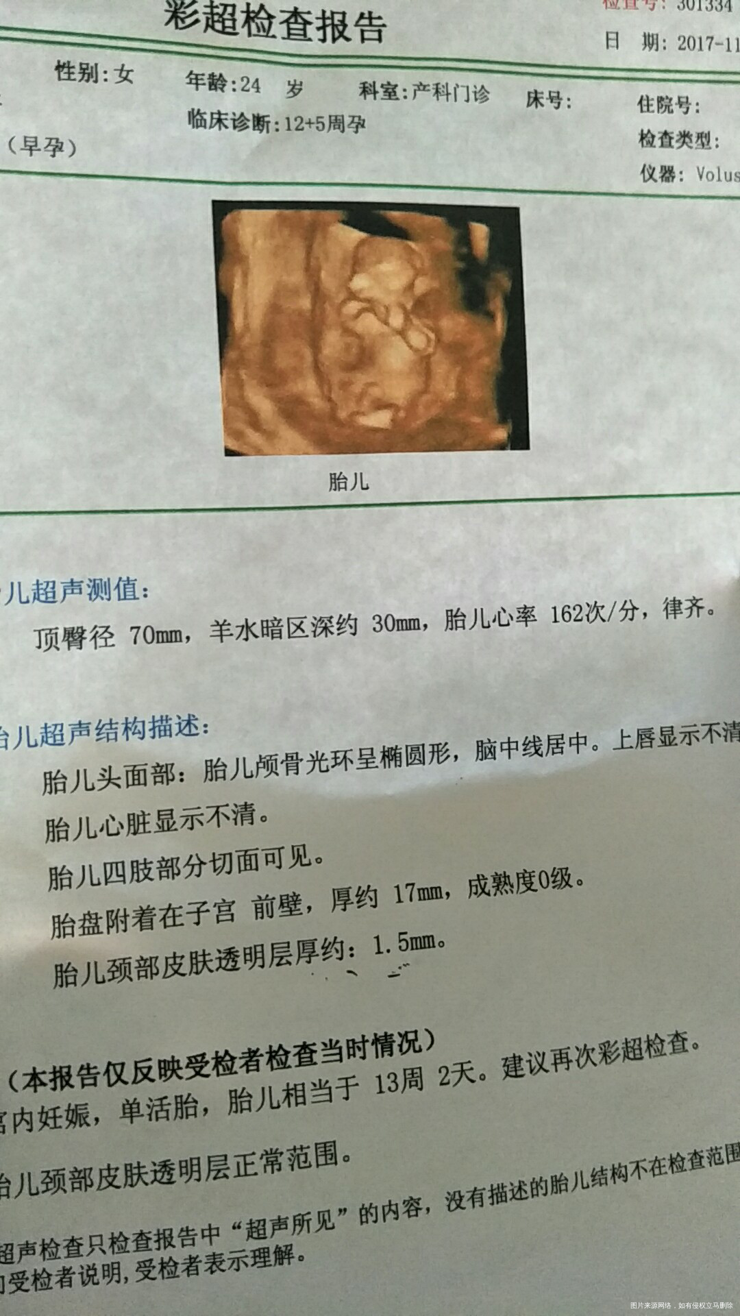 
约了6号做NT,照了四次宝贝都没躺平,一直坐起,今天终于宝贝给力配合了😘