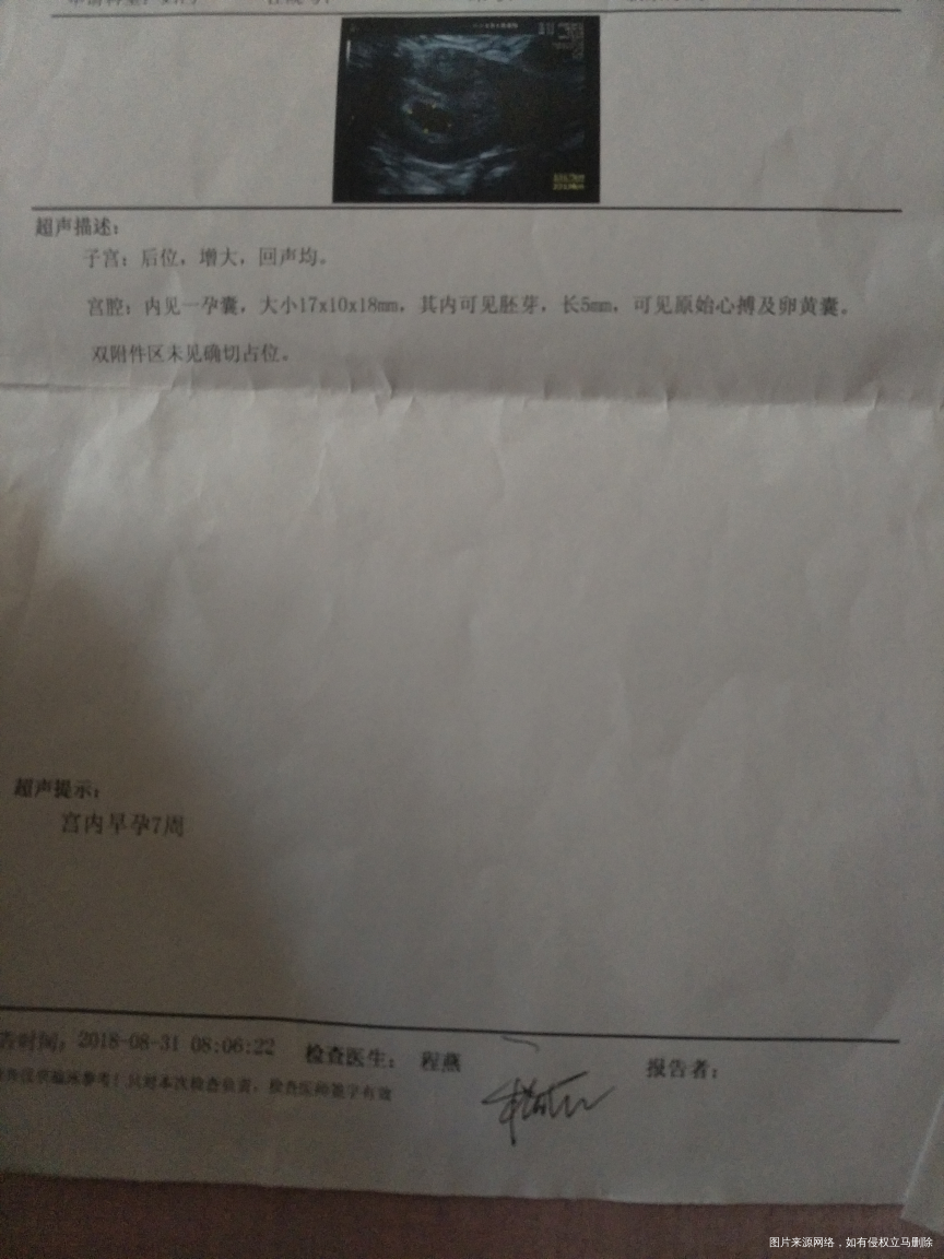 末次月经7/15号,8月30号检查有胎心胎芽,孕酮低