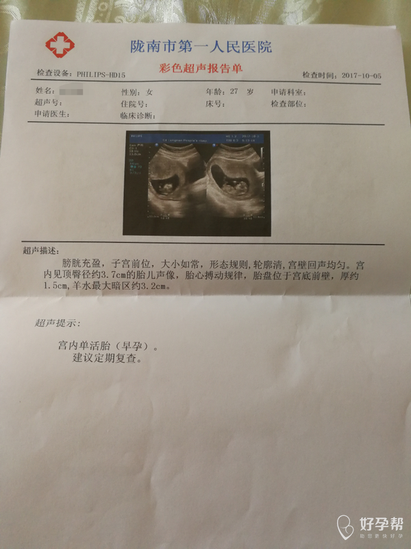 胎儿实际周数是多少周?谢谢