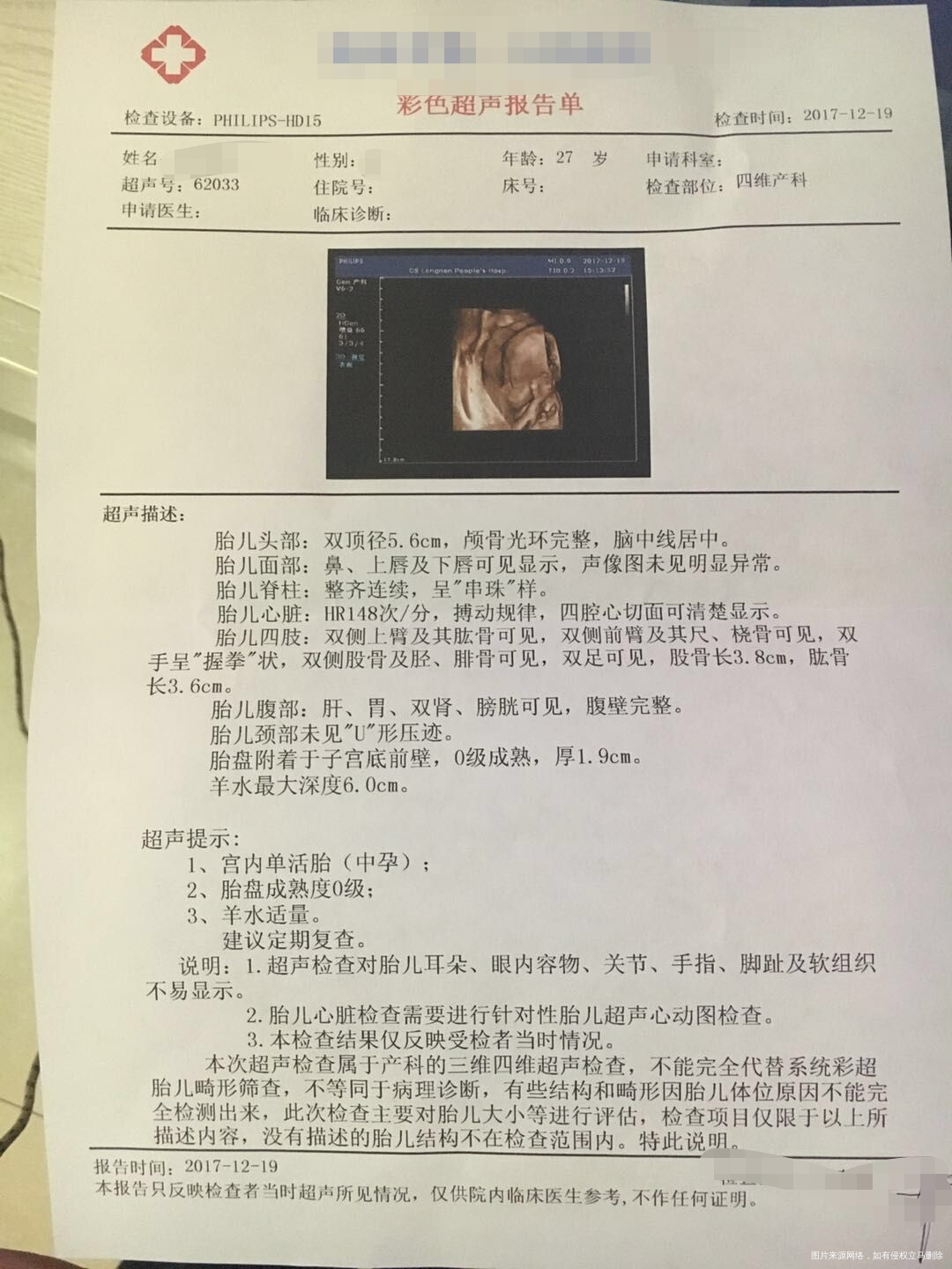今天做的四维彩超,麻烦医生帮忙看看。