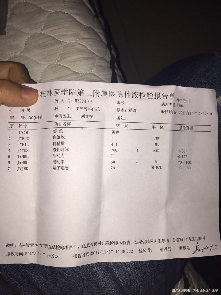 麻烦医生帮看下精子质量问题