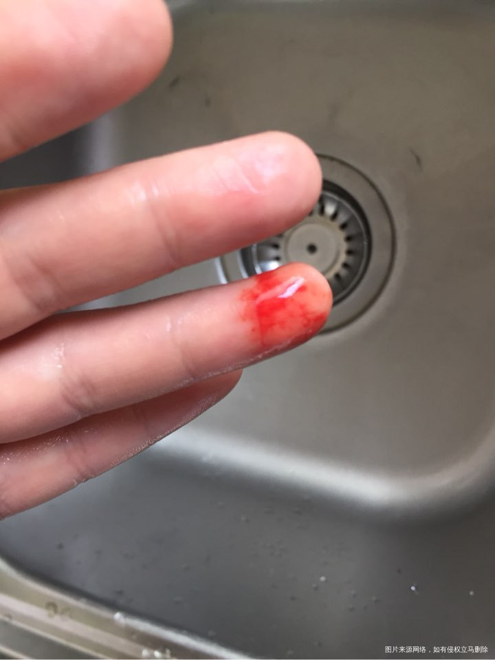 切个鸡翅,把手也顺便切咯!