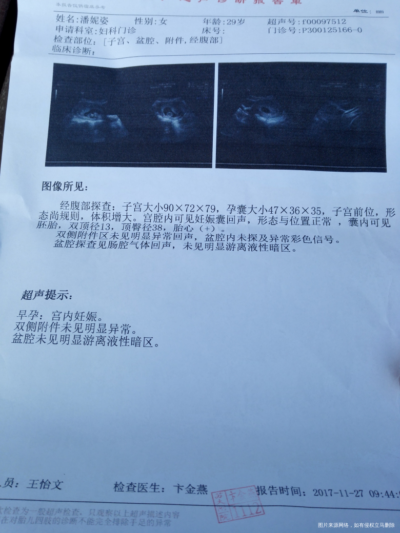 今天去体检了,状态挺好的!
