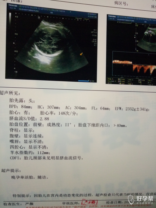 我怀孕35周,今天检查的b超情况