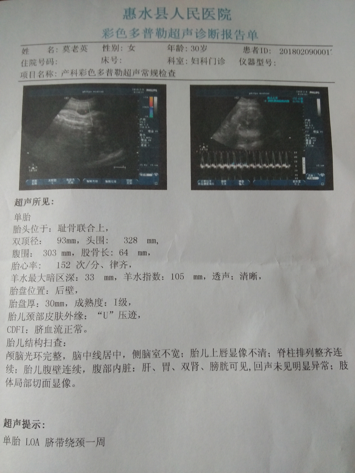 麻烦医生帮我看看，今天的结果