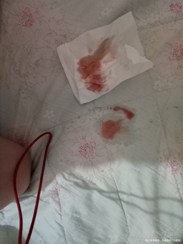 38+5现在见红了,能不能等到天亮