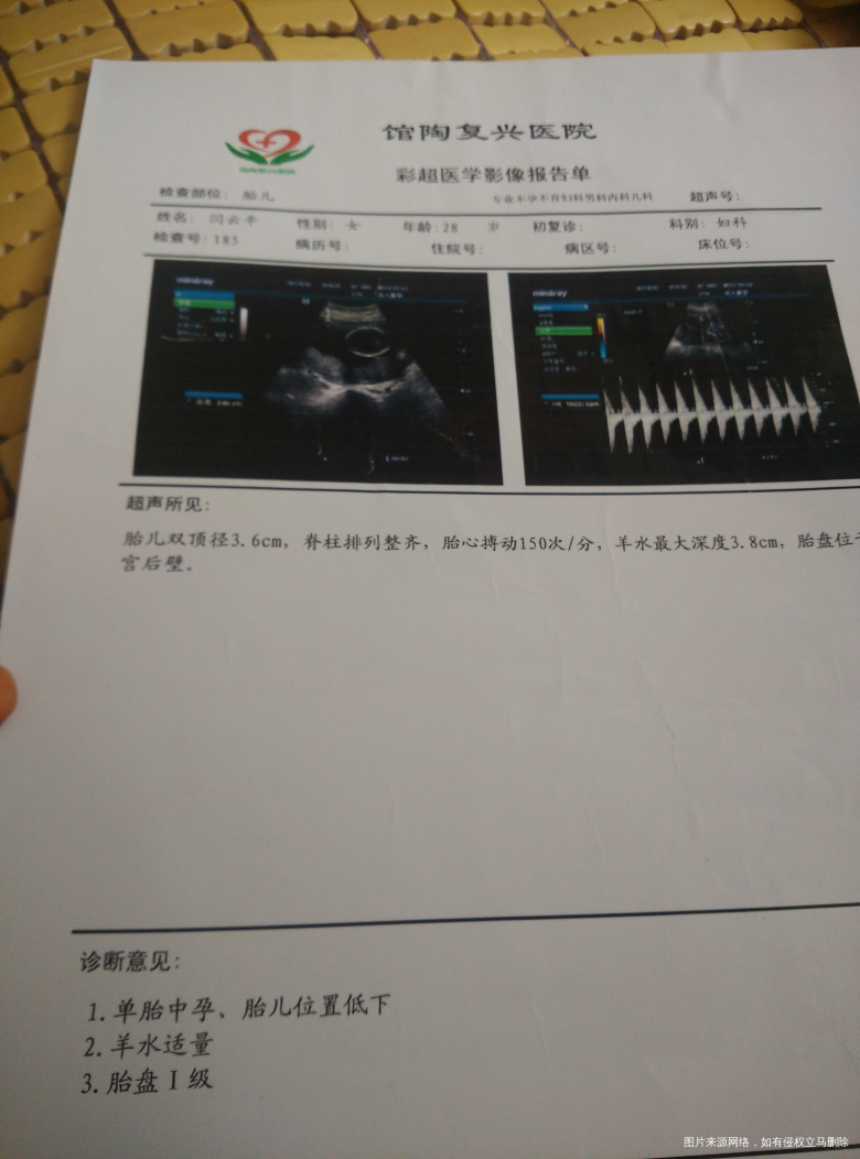 【孕期回顾】说说我这孕中后期的事情