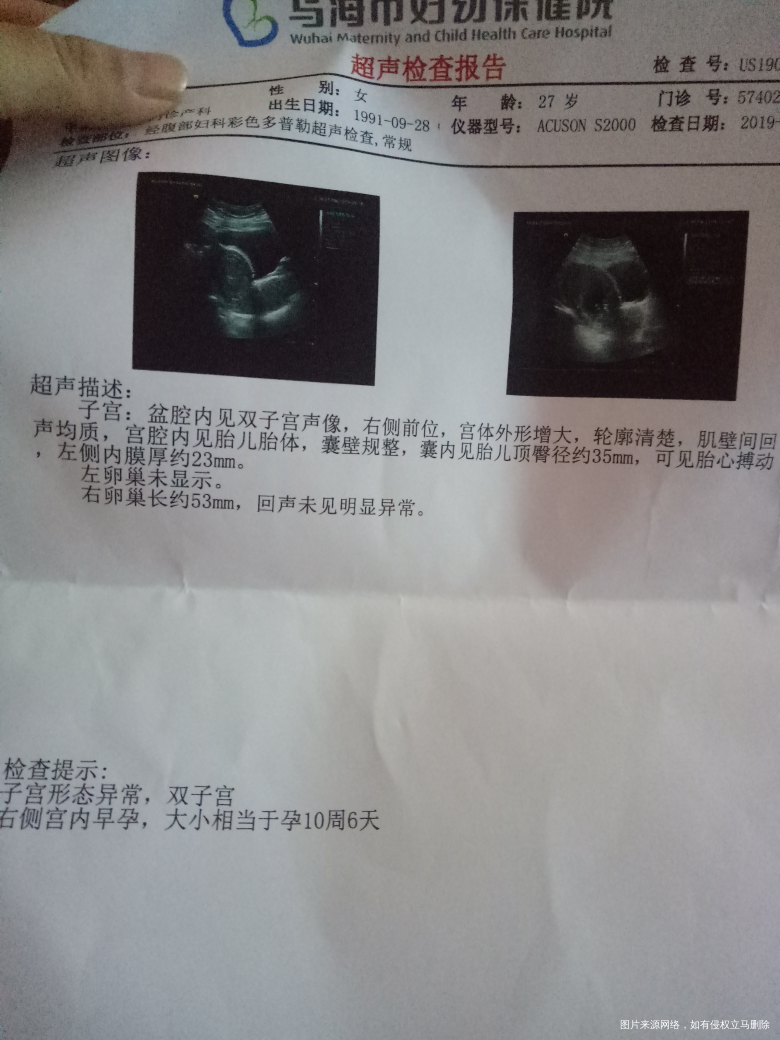 我是一名双子宫患者子宫大小是正常的孕11