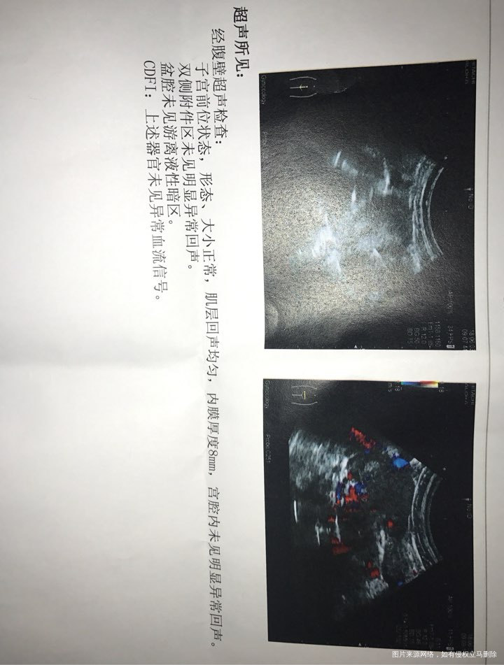 备孕检查,除了垂体泌乳素高,另外的好像还好吧?