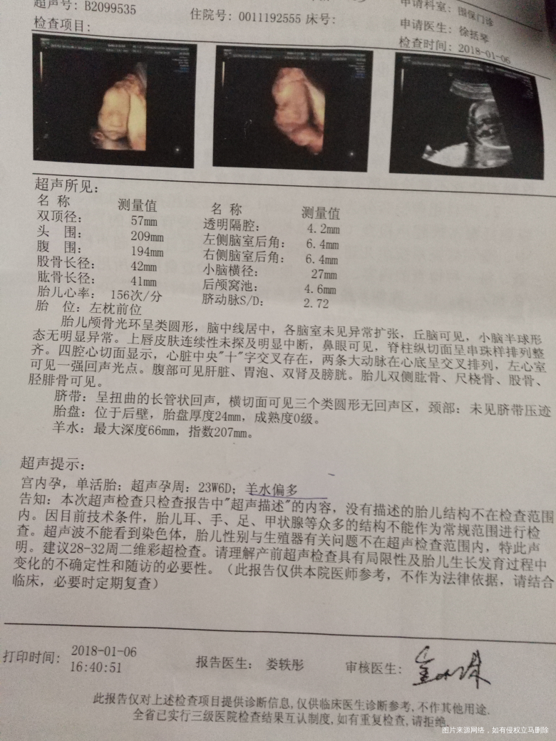 有哪个姐妹会看单子看男女啊,帮忙看看