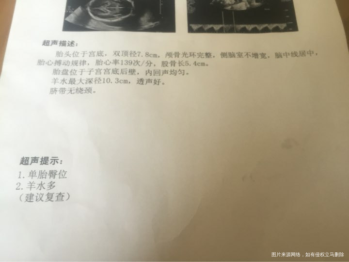 孕28周羊水多麻烦大夫看一下