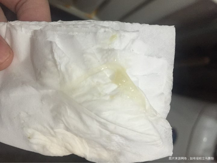 孕28+1天麻烦大夫看看!