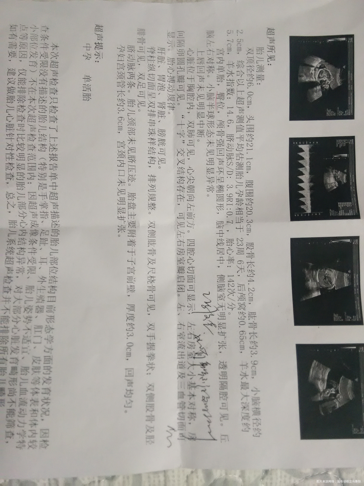 四维结果,请医生帮忙看看