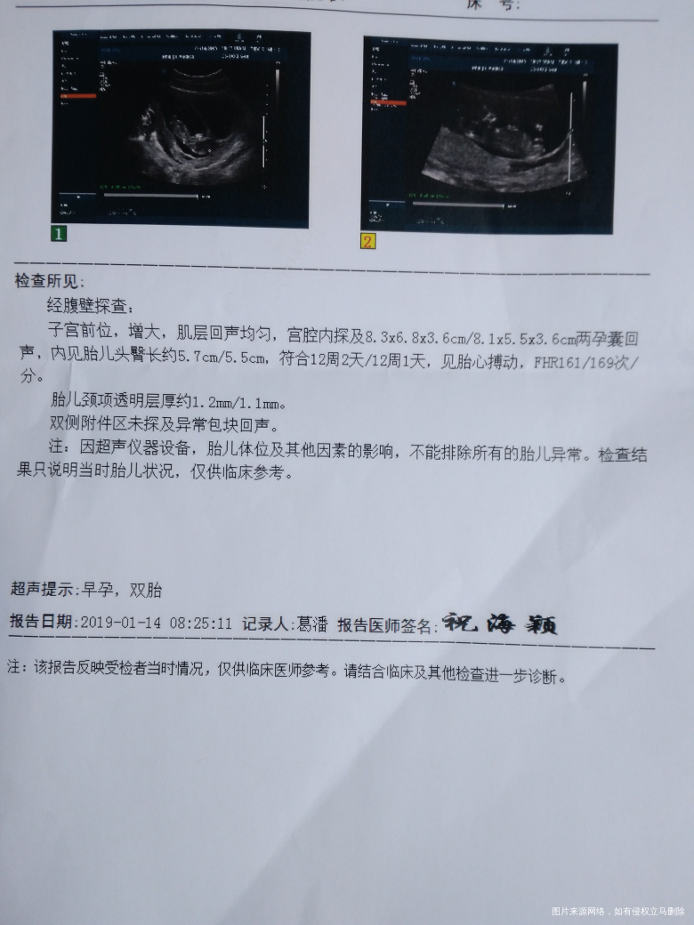 NT值是正常的吧?今天挂不上号,出来结果我就自己走了😁
