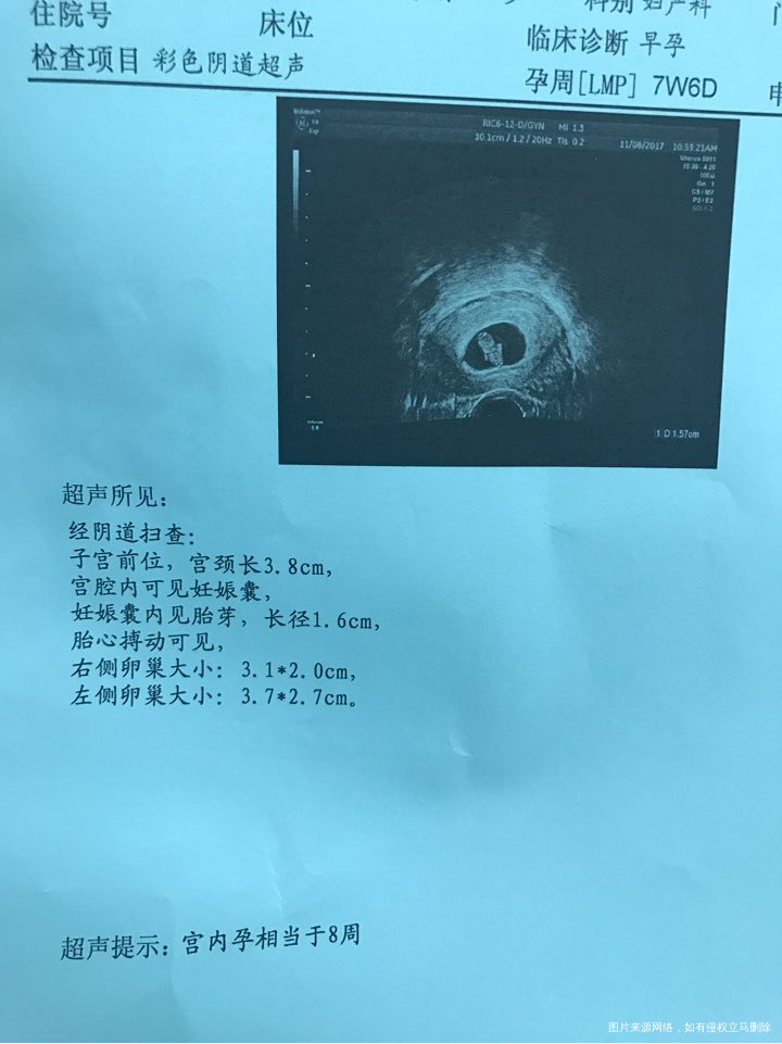 二超顺利过关 宝宝太可爱了