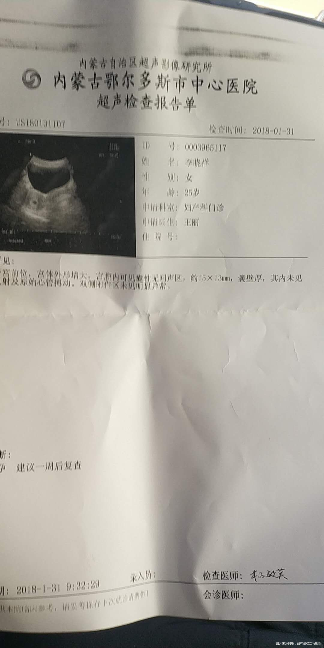 孩子现在多少天了?求告诉我一下