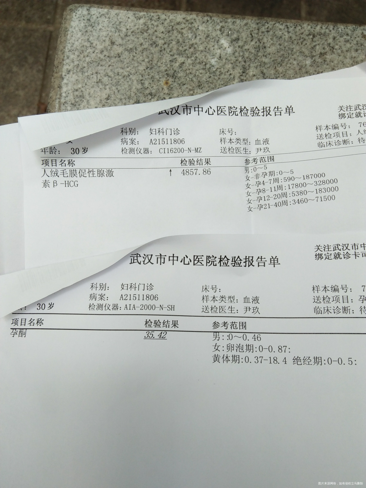 医生麻烦帮我看看,怀孕5+3