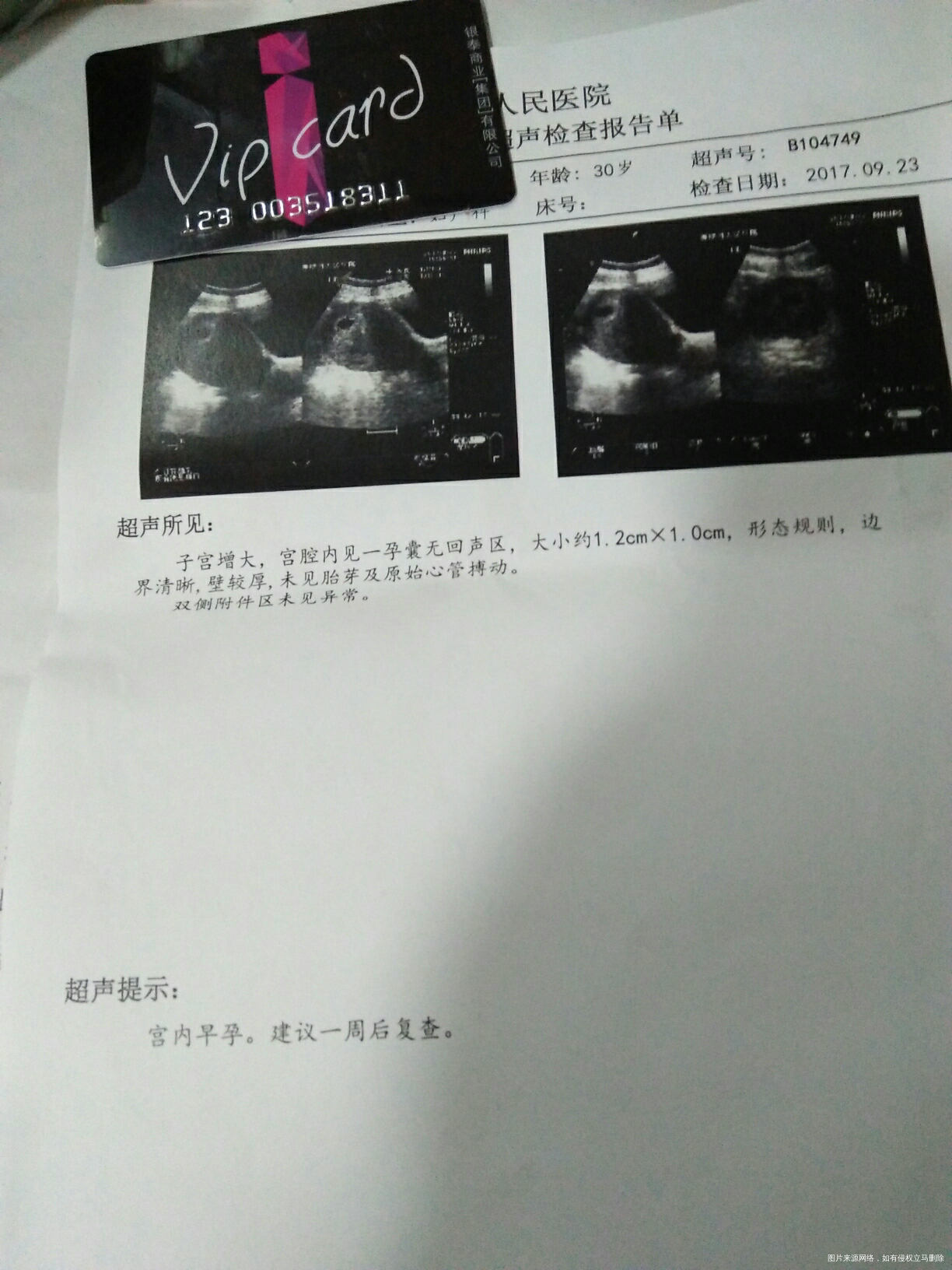 求助医生.麻烦医生帮我看看……