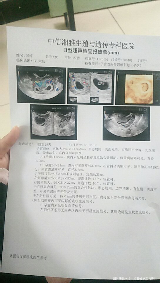 移植28天b超,帮我看下这个单子