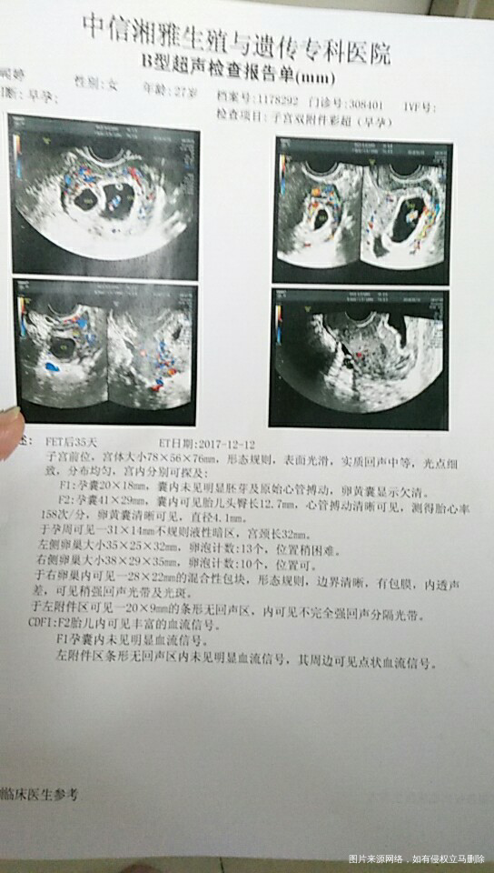 35天复查b超单的结果