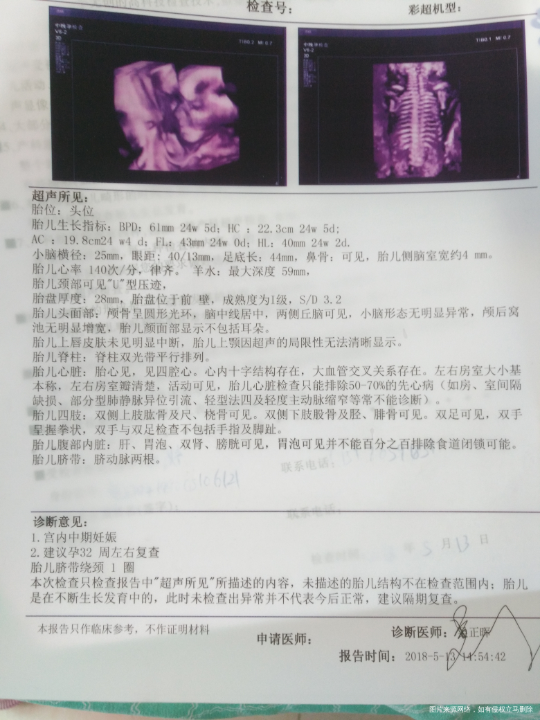 今天去做的四维,帮我看下都还好吧