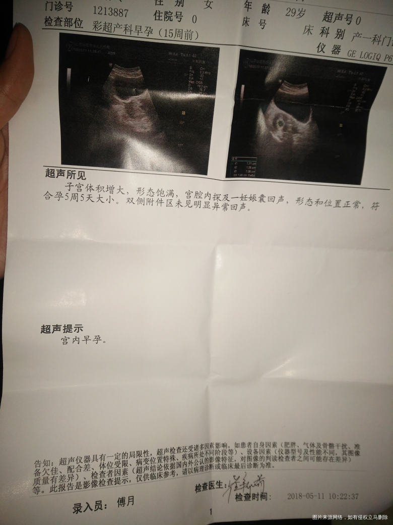 求助!我怀孕6周+5天,昨天洗了个澡,洗完没一会有褐色血,该怎么办啊