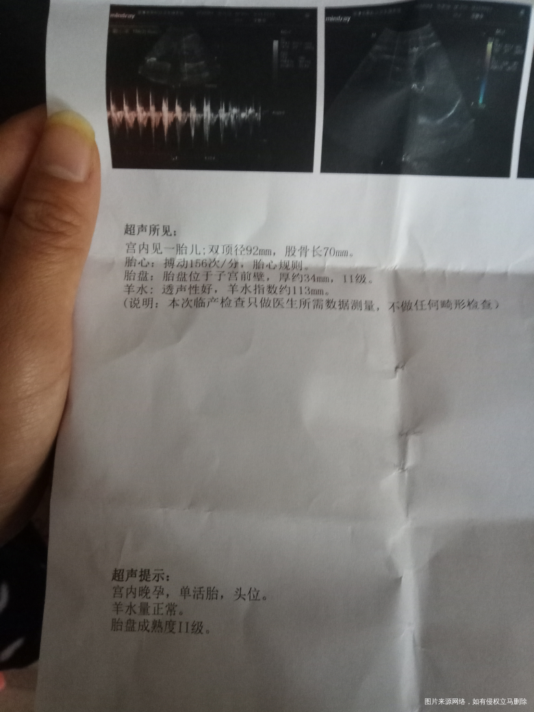 医生帮我算一下婴儿体重,