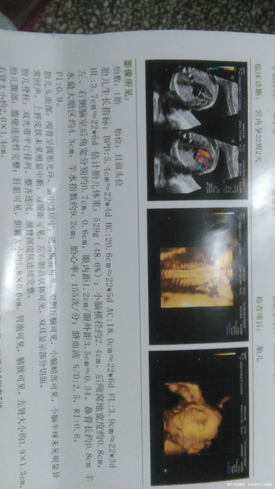 【孕期感悟】回忆孕期的每个第一次