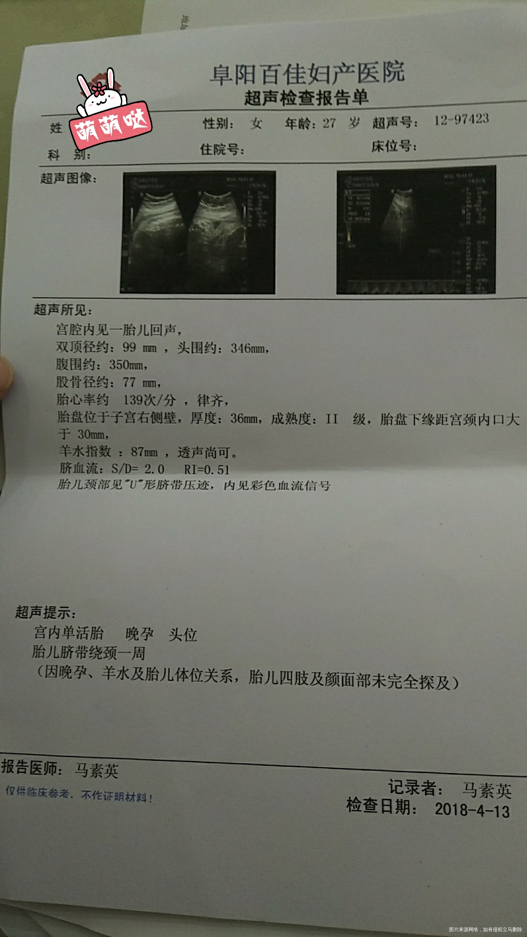 40+2可以去医院催产吗
