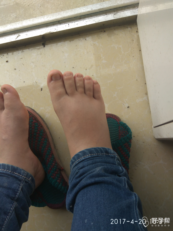 脚肿是什么原因,都查完也没看出来是什么原因