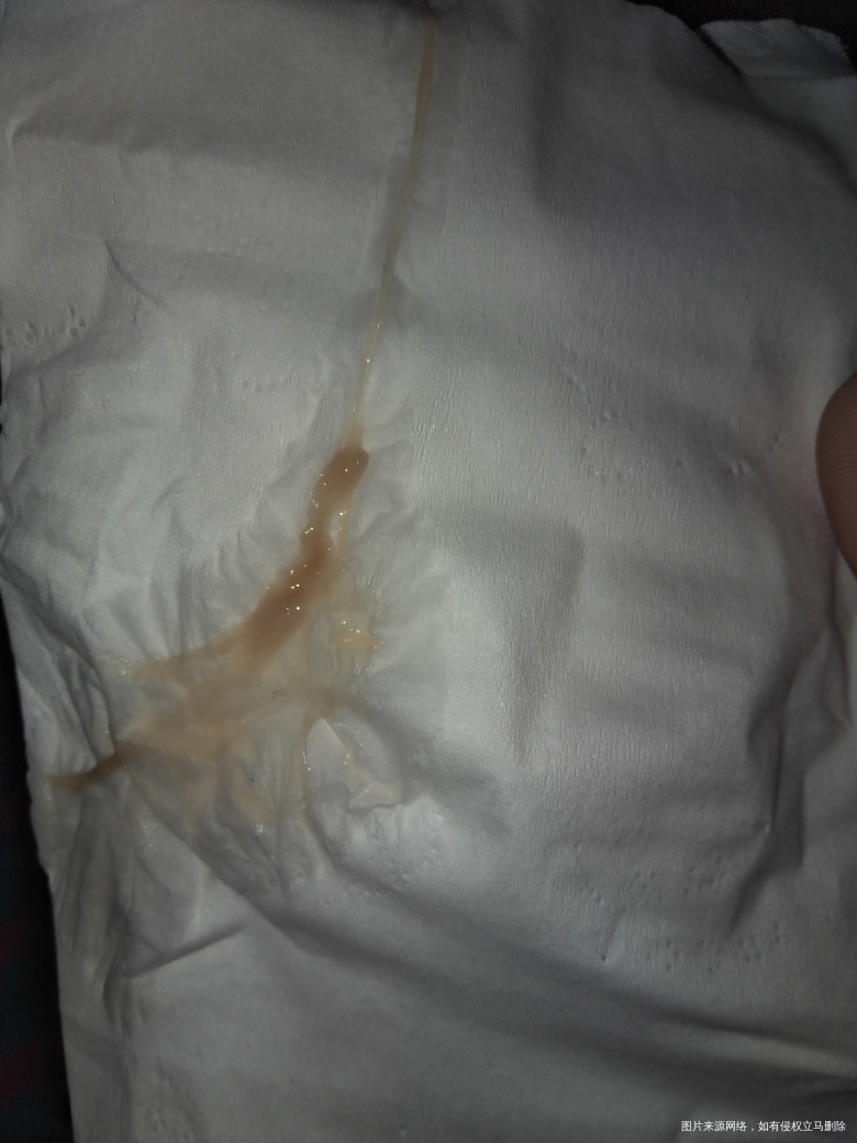 预产期快到了,求助医生帮忙看一下是不是快生了