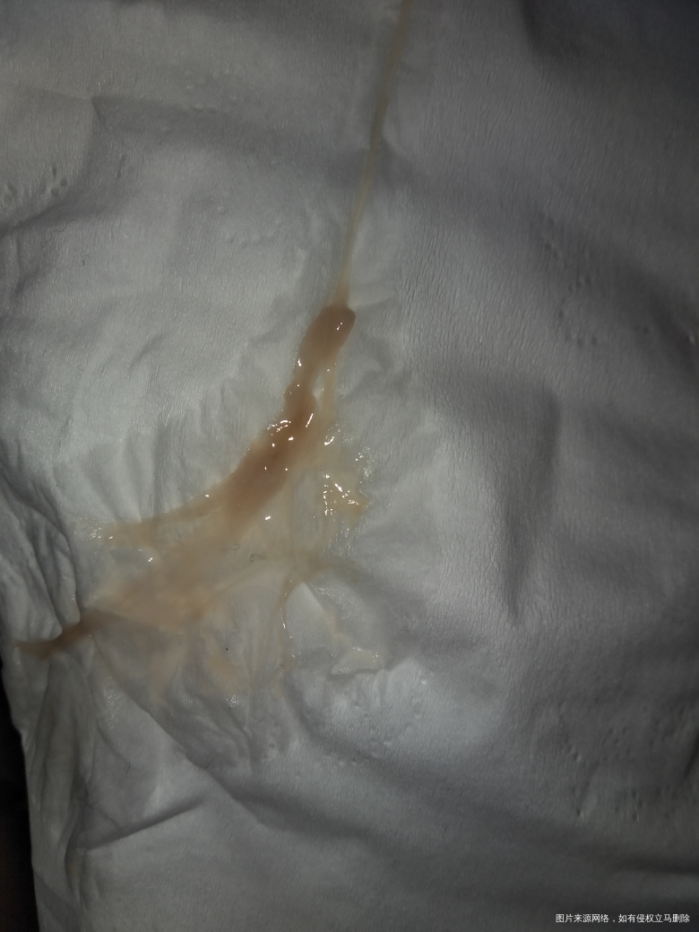 预产期快到了,求助医生帮忙看一下是不是快生了