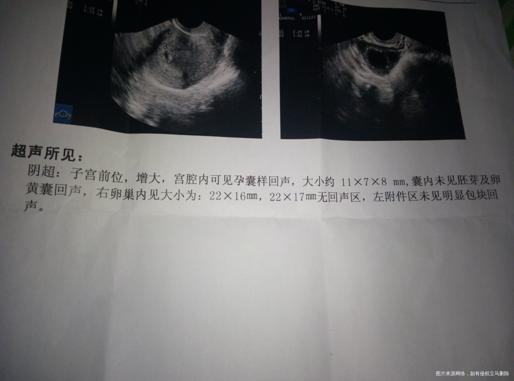 我应该怎么办?第一次怀孕