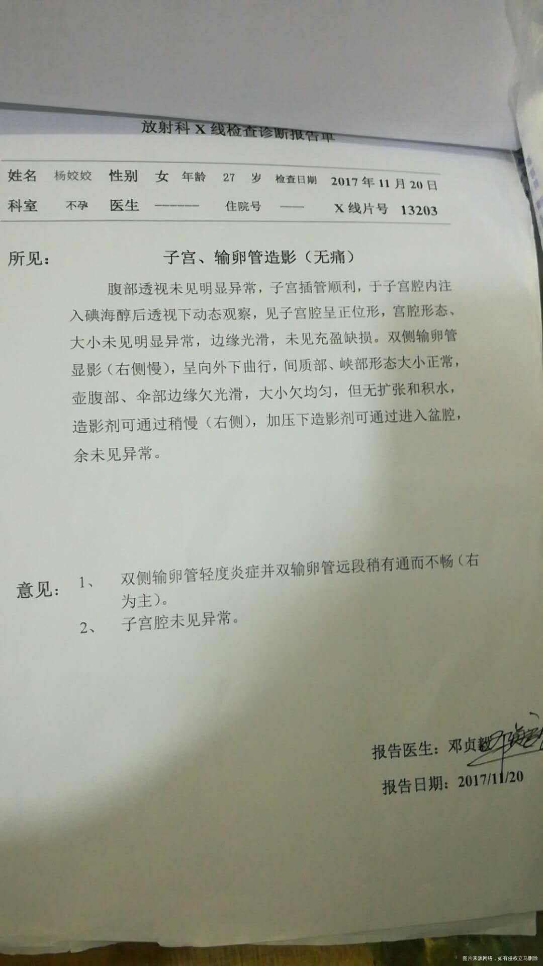 输卵管造影结果如下图