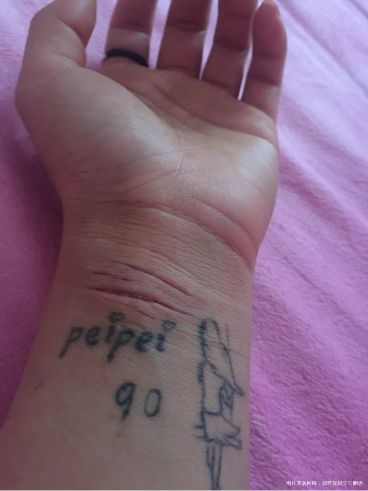 自残第四天,看着伤口觉得自己好傻,觉得自己好傻的时候已经晚了!