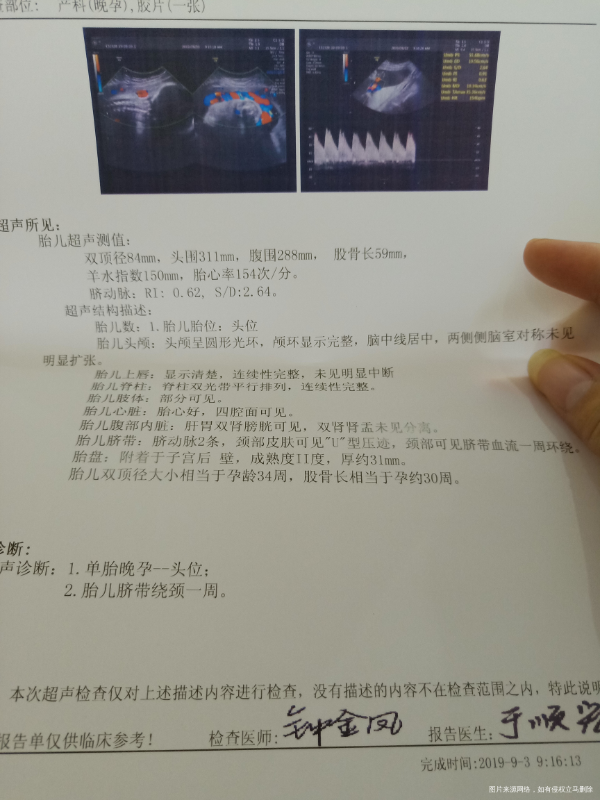 孕32周,胎儿头大两周,腿小两周,算正常吗?