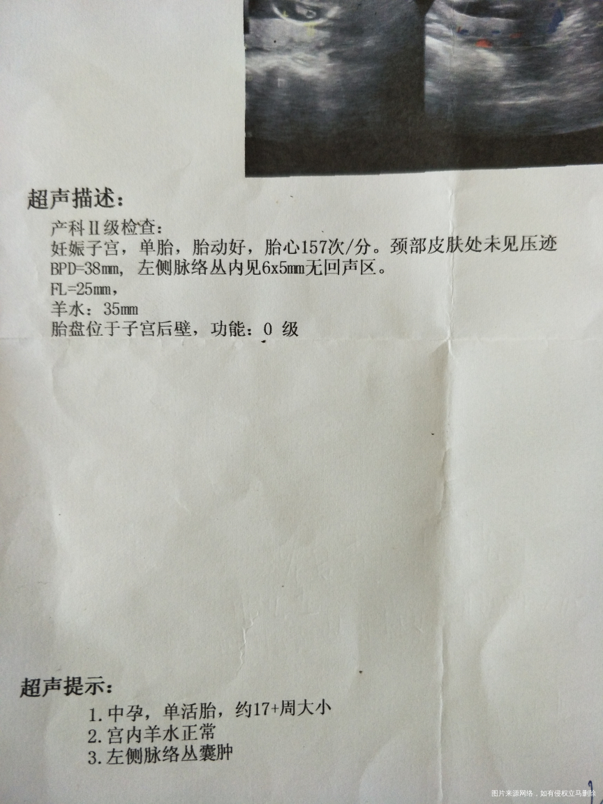 求助,求助,急,有在线医生帮忙看一下