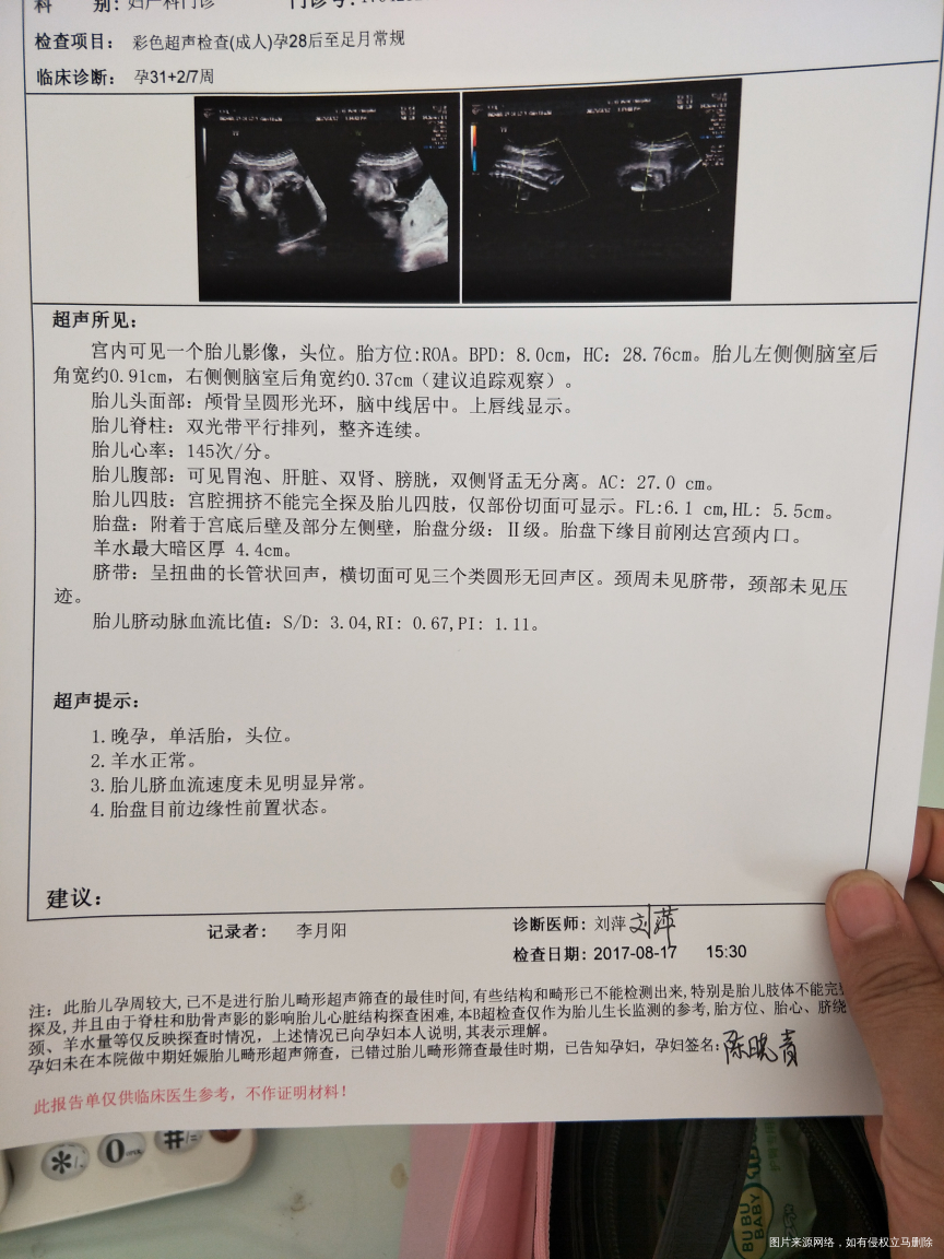 医生帮帮忙,能不能顺产