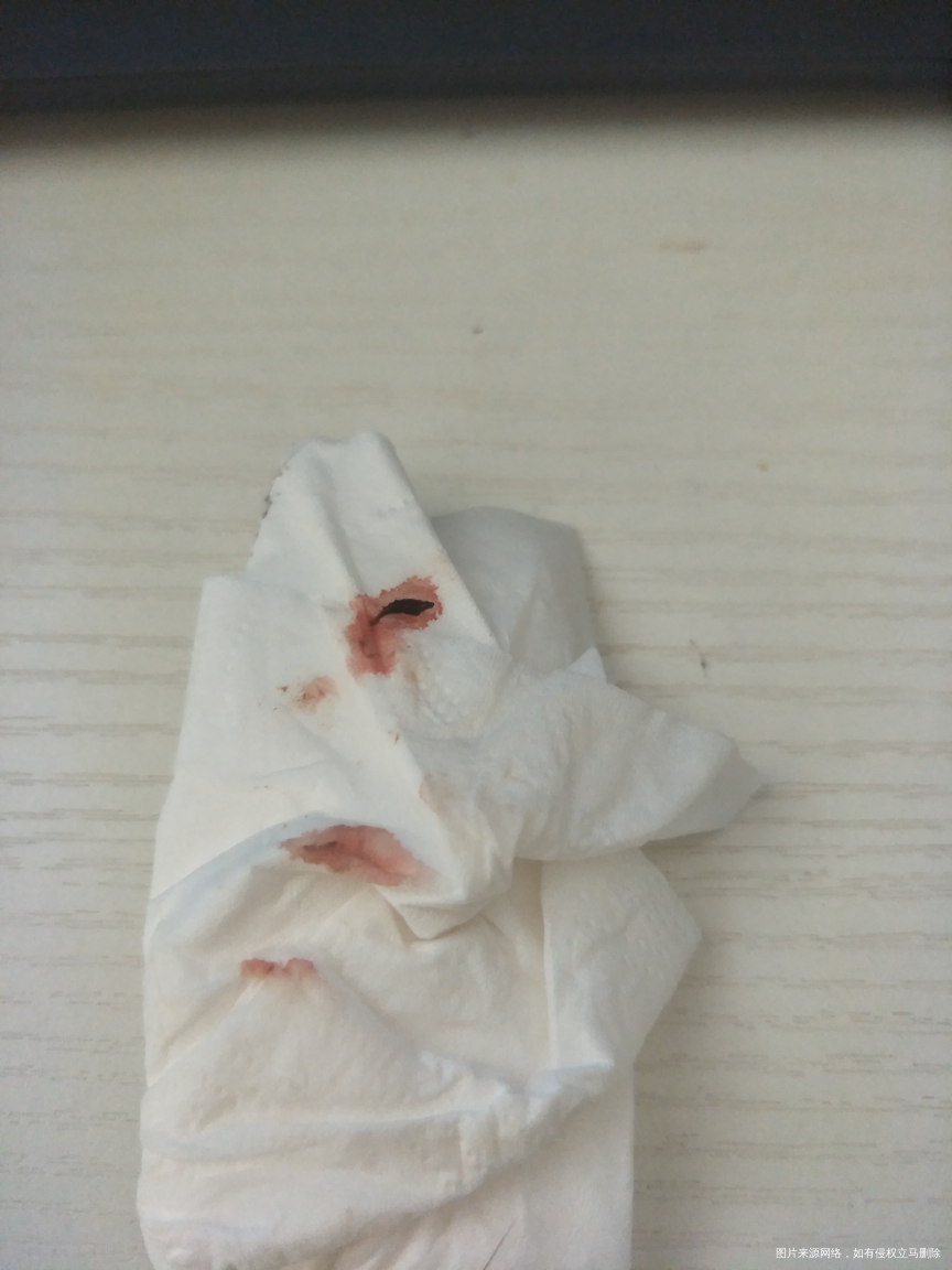 在线医生帮忙看一下,有图慎入