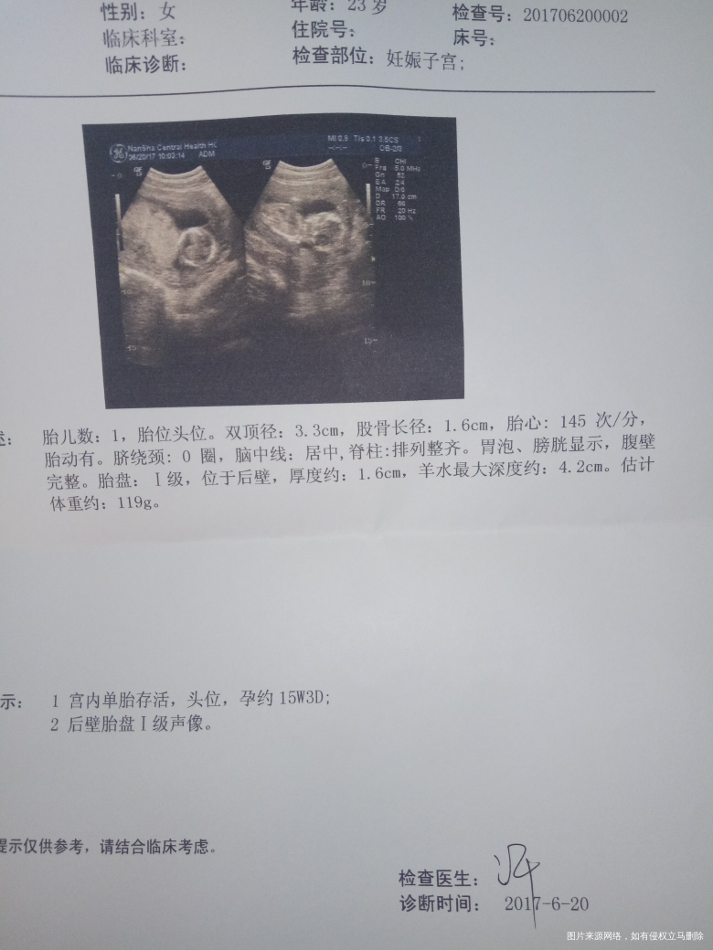 帮忙看看是男宝还是女宝