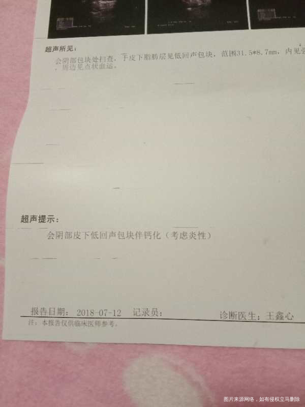 这个是什么状况,急急急