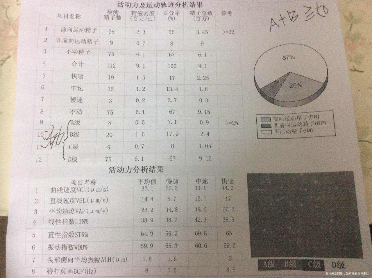 帮忙看下精子的检测结果