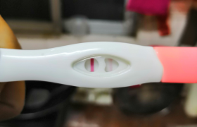 少精症+多囊卵巢，泰国试管婴儿一次成功好孕