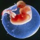俄罗斯试管婴儿：移植胚胎反复不着床，可能是这些原因造成的！