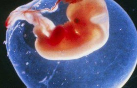 俄罗斯试管婴儿：移植胚胎反复不着床，可能是这些原因造成的！