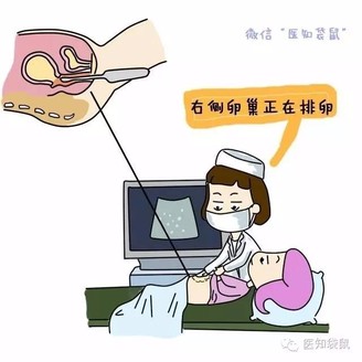 b超测排需要注意事项