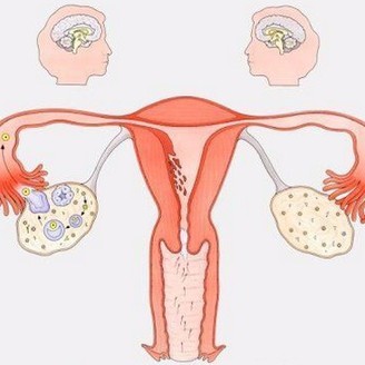 宫颈息肉影响怀孕，有宫颈息肉怀孕容易吗